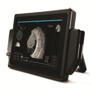 B Scan VuPAD